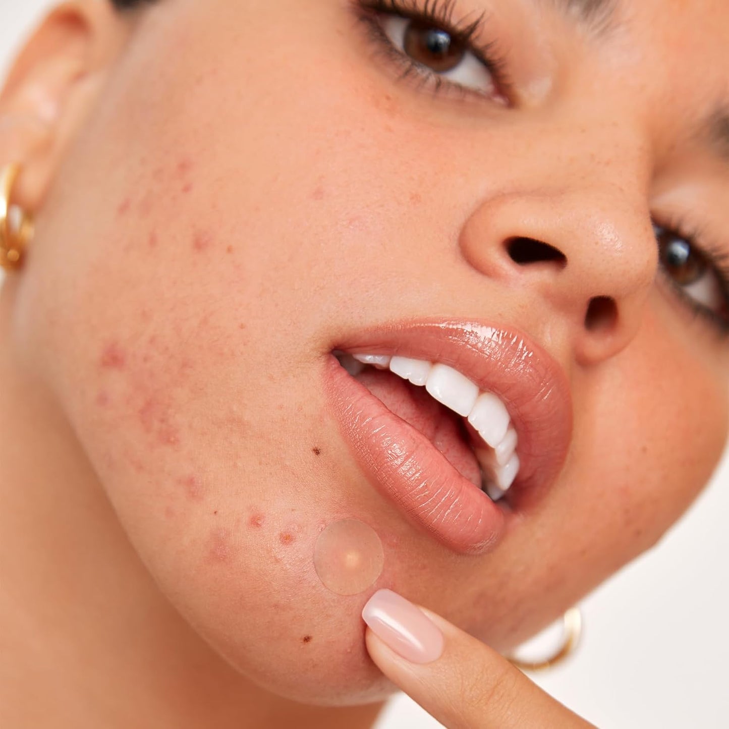 Acne Healing Dots Helps Clear Blemishes Overnight, Fast Acting Hydrocolloid Pimple Patches for Breakouts with Salicylic Acid, Retinol and Aloe Vera, Award Winning Skincare Solution 60 Count